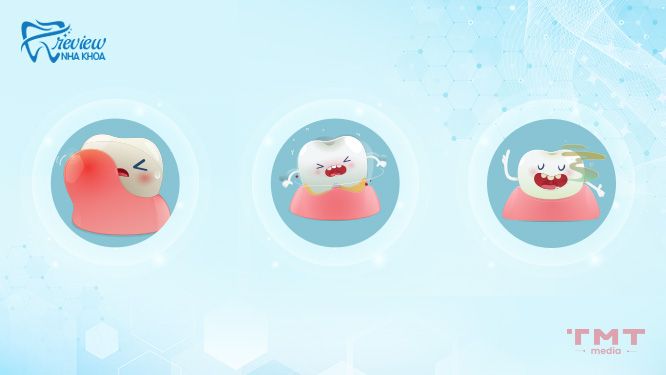 Người có răng cửa thưa ảnh hưởng như thế nào?