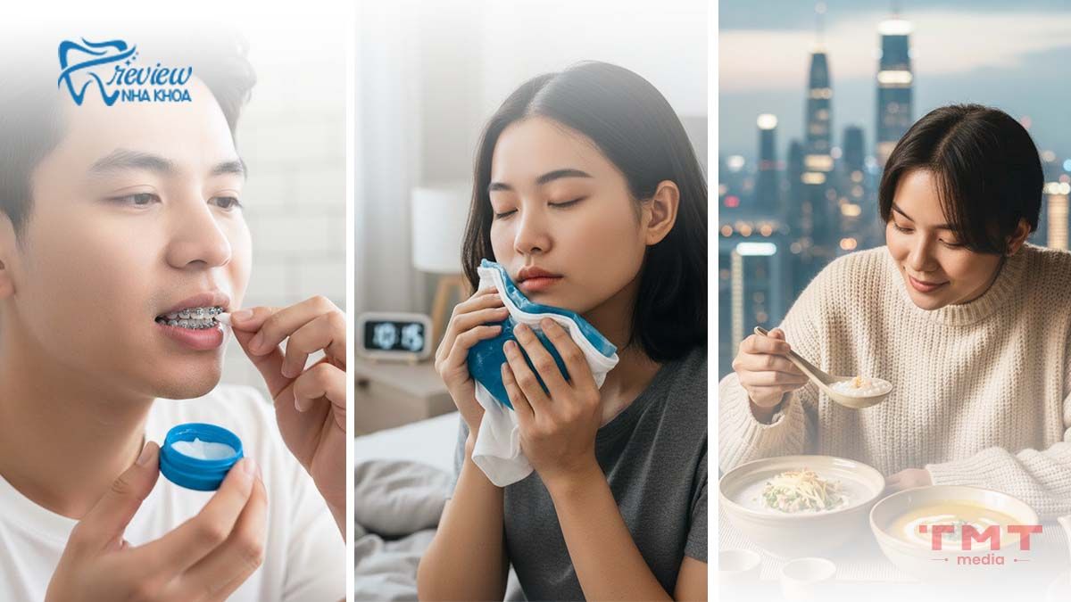 Cách giảm đau khi niềng răng trong suốt 