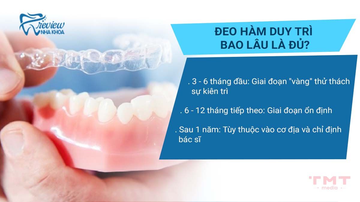 Đeo hàm duy trì bao lâu là đủ?